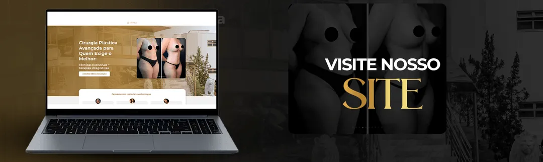 Botão para Visite Nosso Site